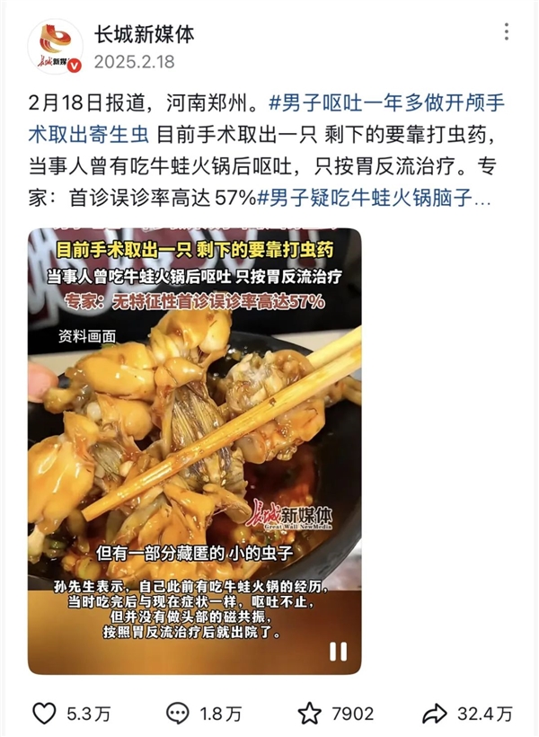 男子呕吐一年多 开颅手术取出寄生虫 原因竟是大家常吃的火锅